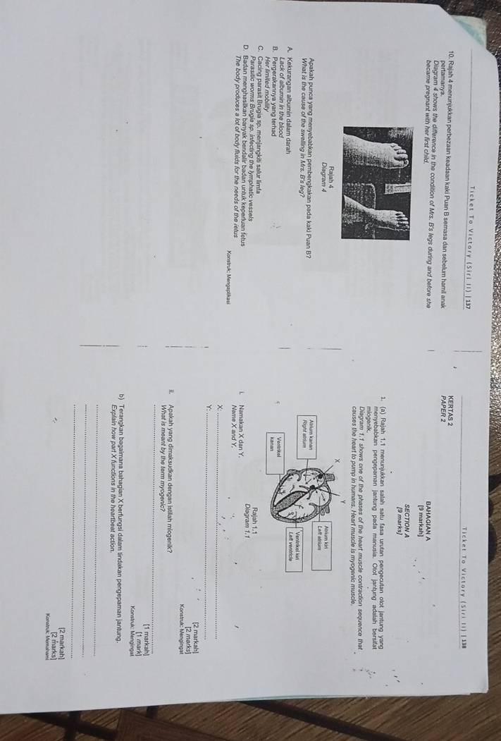 Ticket To Victory (Sirl II) |137  Ticket To Victory (Siri li) | 138
10. Rajah 4 menunjukkan perbezaan keadaan kaki Puan B semasa dan sebelurn hamil anak PAPER 2 KERTAS 2
pertamanya.
Diagram 4 shows the difference in the condition of Mrs. B's legs during and before she
became pregnant with her first child. BAHAGIAN A [9 markah]
section A
[9 marks]
1. (a) Rajah 1.1 menunjukkan salah satu fasa urutan pengecutan olot jantung yang
miogenik menyebabkan pengepaman jantung pada manusia. Otot jantung adalah bersifat
Diagram 1.1 shows one of the phases of the heart muscle contraction sequence that
causes the heart to pump in humans. Heart muscle is myogenic muscle.
Rajah 4
Diagram 4 
Apakah punca yang menyebabkan pembengkakan pada kaki Puan B? 
What is the cause of the swelling in Mrs. B's leg?
A. Kekurangan albumin dalam darah
Lack of albumin in the blood
B. Pergerakannya yang terhad 
Her limited mobility
C. Cacing parasit Brugia sp. menjangkiti salur limfa Diagram 1.1 Rajah 1.1
Parasitic worms Brugia sp. infecting the lymphatic vessels
D. Badan menghasilkan banyak bendalir badan untuk keperluan fetus i. Namakan X dan Y。
The body produces a lot of body fluids for the needs of the ietus Konstruk: Mengaplikasi Name X and Y.
X:
_
Y:_
[2 markah]
Konstruk Mengingat [2 marks]
ii. Apakah yang dimaksudkan dengan istilah miogenik?
_
What is meant by the term myogenic?
[1 markah]
Konstruk: Mengingat [1 mark]
b) Terangkan bagaimana bahagian X berfungsi dalam tindakan pengepaman jantung.
Explain how part X functions in the heartbeat action.
_
_
_
[2 markah]
[2 marks]