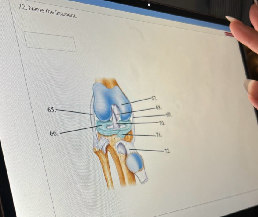 Name the ligament.