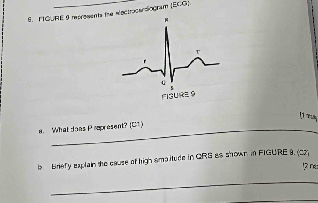 FIGURE 9 represents the electrocardiogram (ECG). 
[1 mark] 
a. What does P represent? (C1) 
b. Briefly explain the cause of high amplitude in QRS as shown in FIGURE 9. (C2) 
[2 mar 
_ 
_