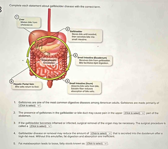 Complete each statement about gallbl 
1. Gallstones are one of the most common digestive diseases among American adults. Gallstones are made primarily of 
(Click to select) √. 
2. The presence of gallstones in the gallbladder or bile duct may cause pain in the upper [(Click to select) ν part of the 
abdomen. 
3. If the gallbladder becomes inflamed or infected, surgical removal of the organ may be necessary. The surgical procedure is 
called a (Click to select) 
4. Gallbladder disease or removal may reduce the amount of (Click to select) that is secreted into the duodenum after a 
high-fat meal. Without this emulsifier, fat digestion and absorption are inefficient. 
5. Fat malabsorption leads to loose, fatty stools known as (Click to select)