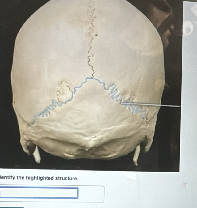 dentify the highlighted structure.