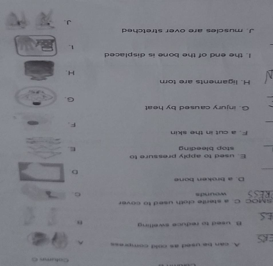 Cotumn C
A. can be used as cold compress A
_
B. used to reduce swelling
8
_
SMOC C. a sterile cloth used to cover
wounds
C
D. a broken bone
_
D.
E. used to apply pressure to
_
stop bleeding E.
F. a cut in the skin
_
F.
G. injury caused by heat
G.
H. ligaments are torn
H.
I. the end of the bone is displaced
1.
J. muscles are over stretched
J.