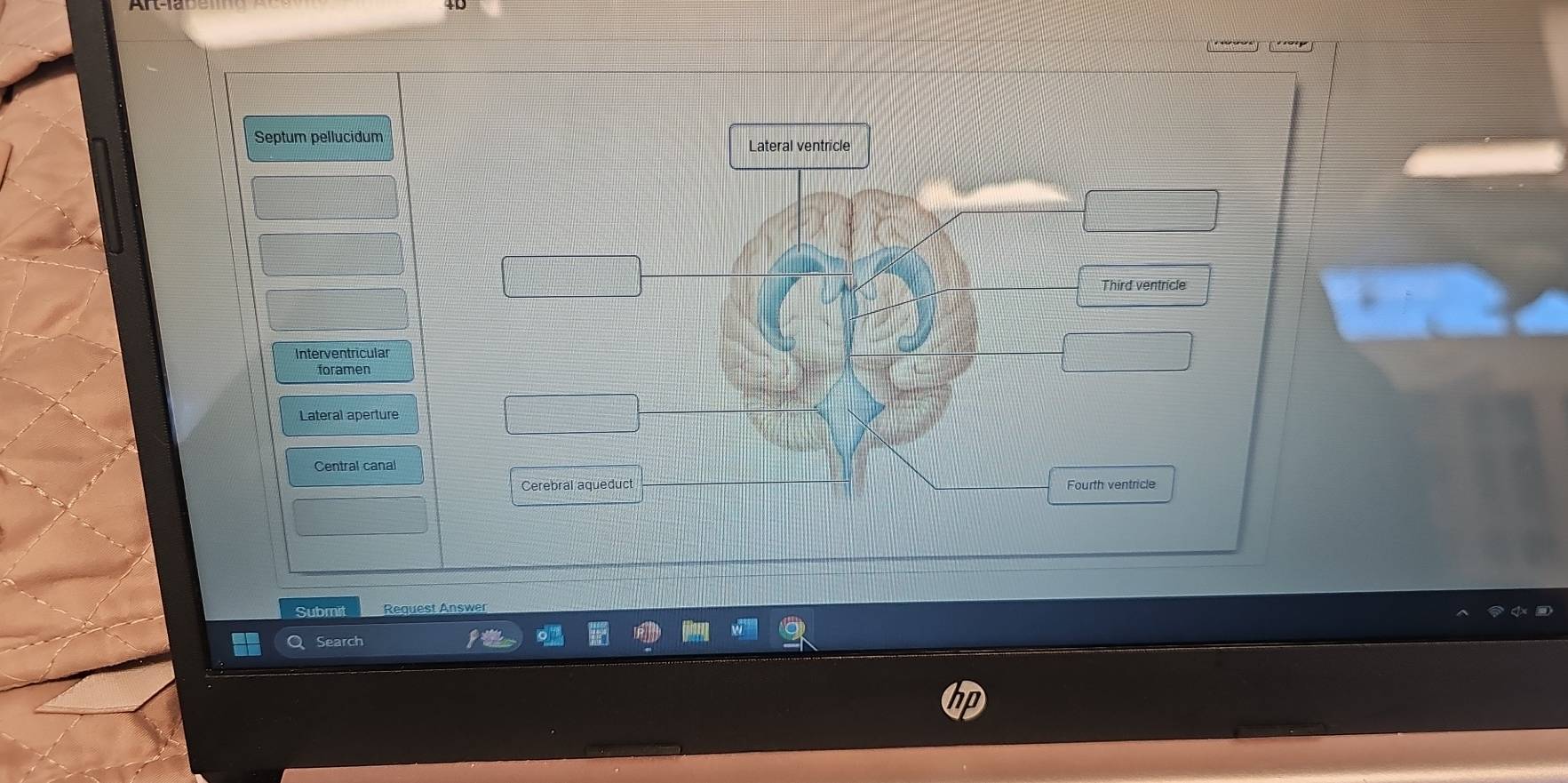 Septum pellucidum Lateral ventricle
Third ventricle
Interventricular
foramen
Lateral aperture
Central canal
Cerebral aqueduct Fourth ventricle
Submit
Search