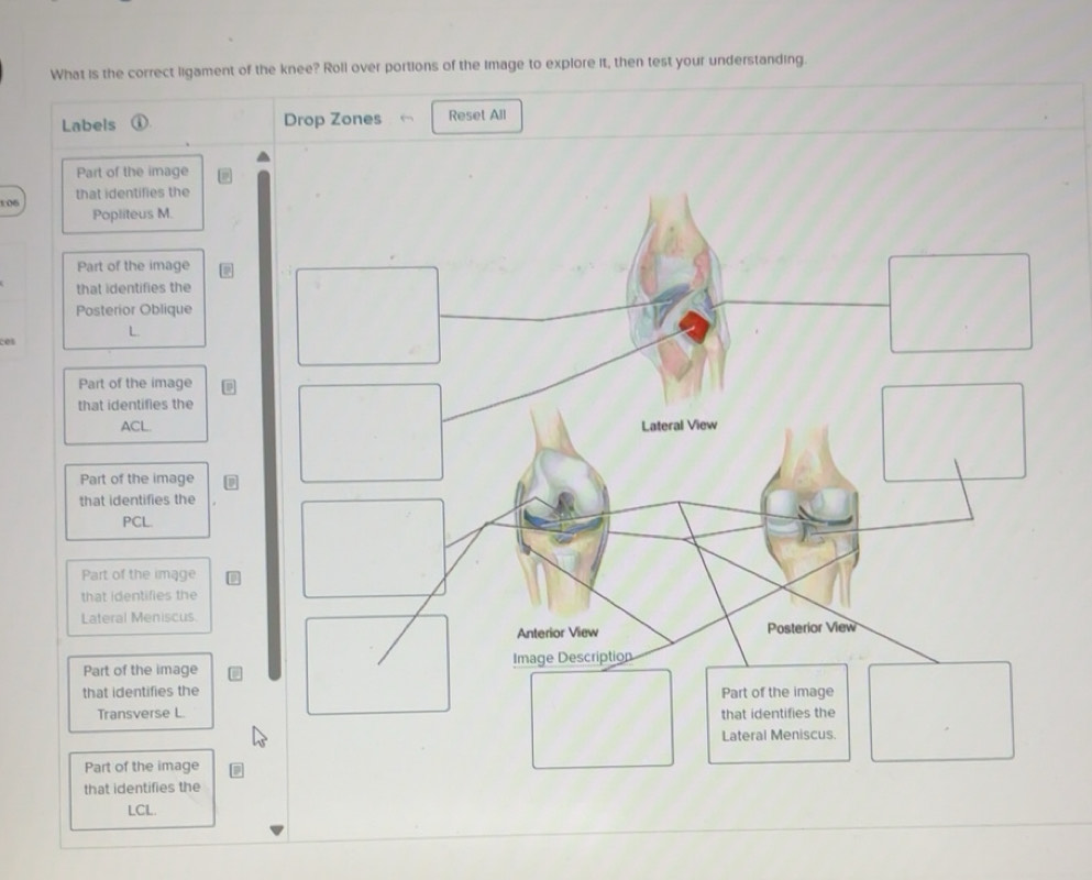 Solved: What is the correct ligament of the knee? Roll over portions of ...