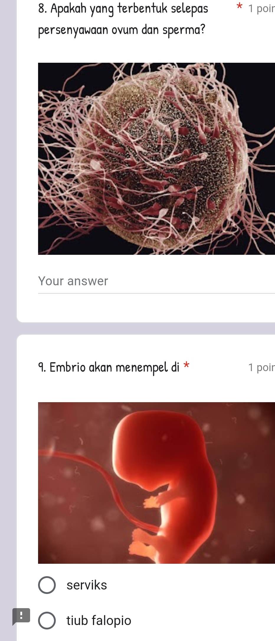 Apakah yang terbentuk selepas 1 poir 
persenyawaan ovum dan sperma? 
Your answer 
9. Embrio akan menempel di * 1 poir 
serviks 
! 
tiub falopio