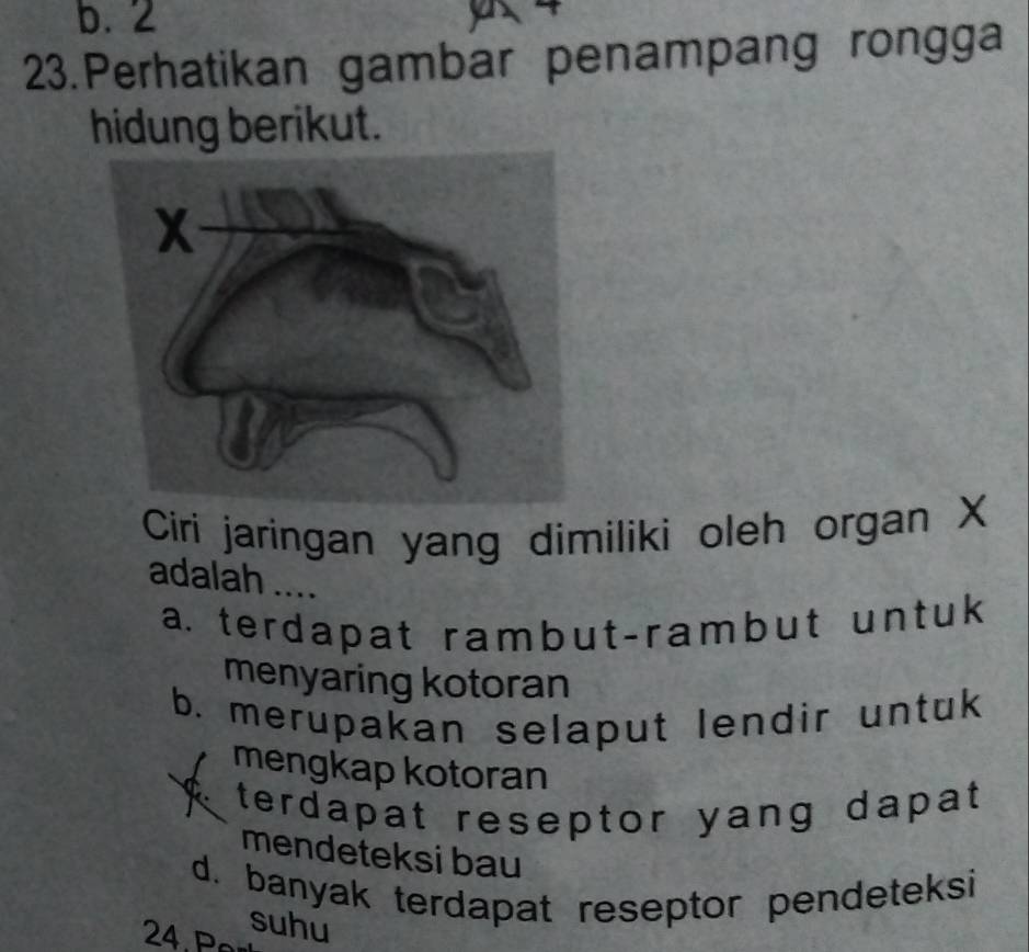 b. 2
23.Perhatikan gambar penampang rongga
hidung berikut.
Ciri jaringan yang dimiliki oleh organ X
adalah ....
a. terdapat rambut-rambut untuk
menyaring kotoran
b. merupakan selaput lendir untuk
mengkap kotoran
terdapat reseptor yang dapat
mendeteksi bau
d. banyak terdapat reseptor pendeteksi
suhu