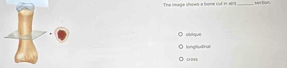 Solved: The image shows a bone cut in a(n) _section. oblique ...