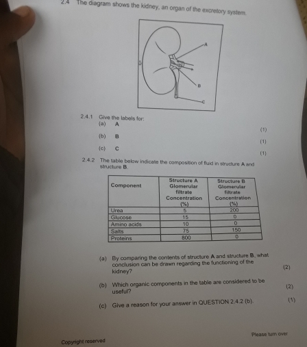 2.4 The diagram shows the kidney, an organ of the excretory system. 
2.4.1 Give the labels for: 
(a) A 
(1) 
(b) B
(c) C (1) 
(1) 
2.4.2 The table below indicate the composition of fluid in structure A and 
structure B. 
a By comparing the contents of structure A and structure B. what 
kidney? conclusion can be drawn regarding the functioning of the 
(2) 
(b) Which organic components in the table are considered to be (2) 
useful? 
(c) Give a reason for your answer in QUESTION 2.4.2 (b). (1) 
Please turn over 
Copyright reserved