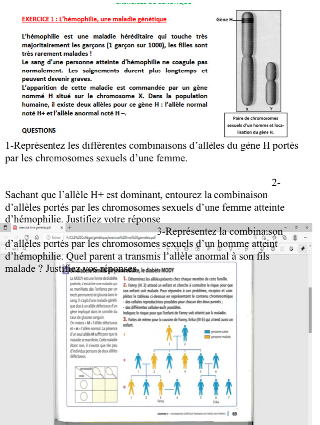 L'hémophilie, une maladie génétique 
L'hémophilie est une maladie héréditaire qui touche très
majoritairement les garçons (1 garçon sur 1000), les filles sont
très rarement malades !
Le sang d'une personne atteinte d'hémophilie ne coagule pas
normalement. Les saignements durent plus longtemps et
peuvent devenir graves.
L'apparition de cette maladie est commandée par un gène
nommé H situé sur le chromosome X. Dans la population
humaine, il existe deux allèles pour ce gène H : l'allèle normal
noté H+ et l'allèle anormal noté H -. 
QUESTIONS 
1-Représentez les différentes combinaisons d'allèles du gène H portés
par les chromosomes sexuels d’une femme.
2-
Sachant que l’allèle H+ est dominant, entourez la combinaison
d'allèles portés par les chromosomes sexuels d'une femme atteinte
d'hémophilie. Justifiez votre réponse
3-Représentez la combinaison
d'allèles portés par les chromosomes sexuels d'un homme atteint
d'hémophilie. Quel parent a transmis l'allèle anormal à son fils
malade ? Justifica vos réponse se, le diabète MODY
Le MODY est une forme de diabète 1. Déterminez les allèles présents chez chaque membre de cette famille.
juvénile, c'est à dire une maladie qui
se manifeste dès l'enfance par un 2. Fanny (III 3) attend un enfant et cherche à connaître le risque pour que
excès permanent de glucose dans le son enfant soit malade. Pour répondre à son problème, recopiez et com
sang. Il s'agit d'une maladie généti plétez le tableau ci-dessous en représentant le contenu chromosomique
- des cellules reproductrices possibles pour chacun des deux parents ;
que due à un allèle défectueux d'un  - des différentes cellules œufs possibles.
gène impliqué dans le conbôle du
taux de glucose sanguin. Indíquez le risque pour que l'enfant de Fanny soit atteint par la maladie.
On notera « M « l'allièle défectueu 3. Faites de même pour la cousine de Fanmy, Erika (III 6) qui attend aussi un
et « m « l'allèle normal. La présenc
d'un seul allèle M suffit pour que l
maladie se manifeste. Cette malad
étant rare, il n'existe que très pe
d'individus porteurs de deux allèl
délectueux
| 69