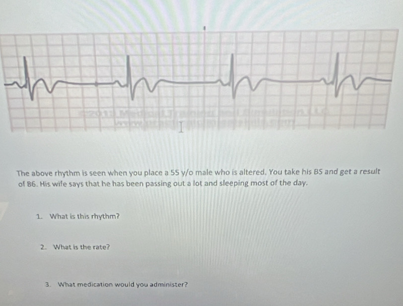 The above rhythm is seen when you place a 55 y/o male who is altered. You take his BS and get a result 
of 86. His wife says that he has been passing out a lot and sleeping most of the day. 
1. What is this rhythm? 
2. What is the rate? 
3. What medication would you administer?