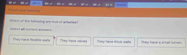 Ql Q2 qo x Q4 Q5 Q6 Q7 Q8 Q x Ressita
Chock your tearning
Which of the following are true of arterles?
Select all correct answers
They have flexible walls They have valves They have thick walls They have a small lumen