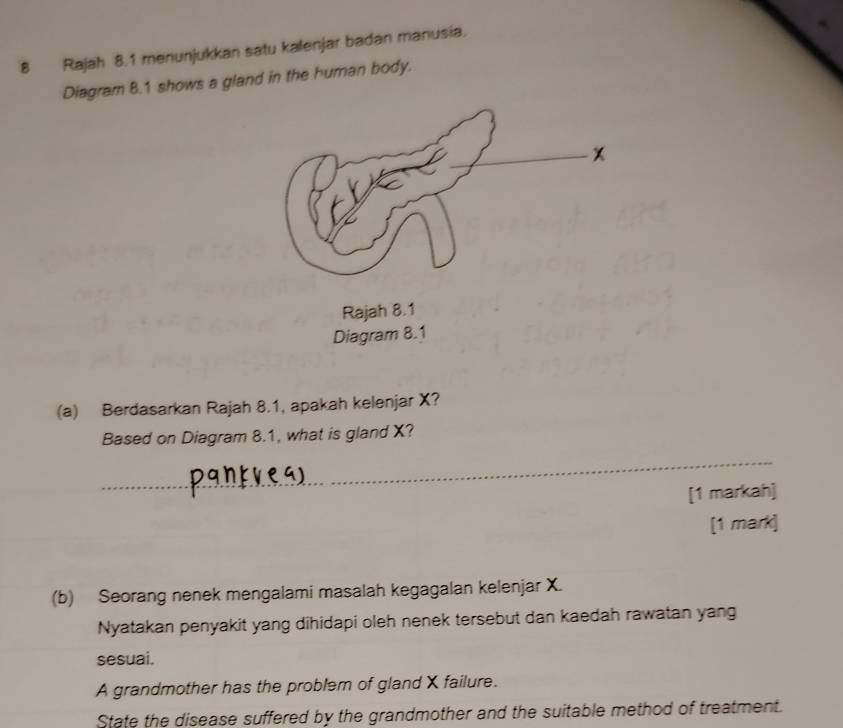 Rajah 8.1 menunjukkan satu kalenjar badan manusia. 
Diagram 8.1 shows a gland in the human body. 
(a) Berdasarkan Rajah 8.1, apakah kelenjar X? 
Based on Diagram 8.1, what is gland X? 
_ 
[1 markah] 
[1 mark] 
(b) Seorang nenek mengalami masalah kegagalan kelenjar X. 
Nyatakan penyakit yang dihidapi oleh nenek tersebut dan kaedah rawatan yang 
sesuai. 
A grandmother has the problem of gland X failure. 
State the disease suffered by the grandmother and the suitable method of treatment.