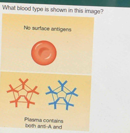 What blood type is shown in this image? 
No surface antigens