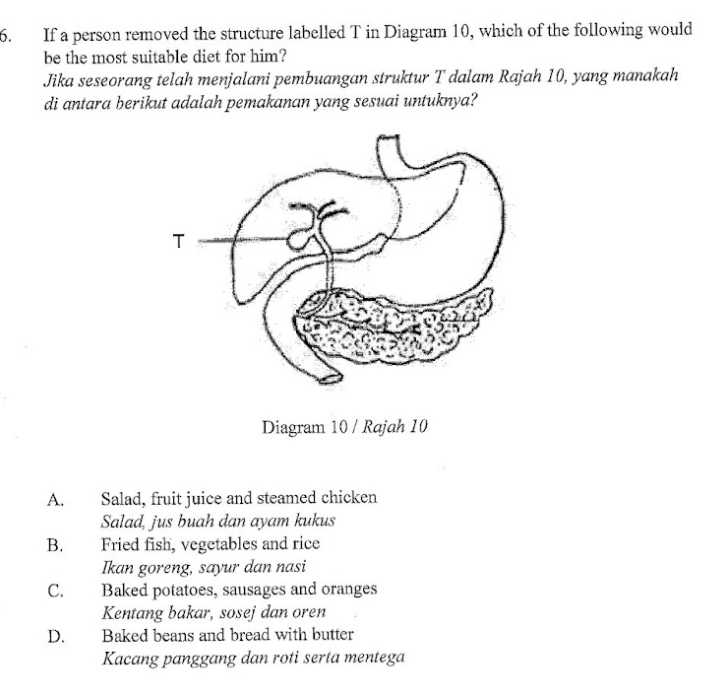 If a person removed the structure labelled T in Diagram 10, which of the following would
be the most suitable diet for him?
Jika seseorang telah menjalani pembuangan struktur T dalam Rajah 10, yang manakah
di antara berikut adalah pemakanan yang sesuai untuknya?
Diagram 10 / Rajah 10
A. Salad, fruit juice and steamed chicken
Salad, jus buah dan ayam kukus
B. Fried fish, vegetables and rice
Ikan goreng, sayur dan nasi
C. Baked potatoes, sausages and oranges
Kentang bakar, sosej dan oren
D. Baked beans and bread with butter
Kacang panggang dan roti serta mentega