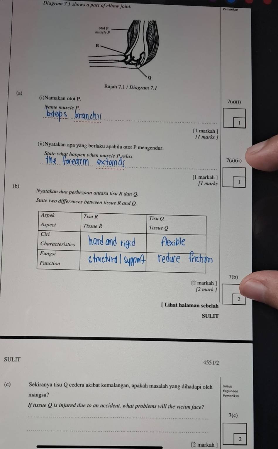 Diagram 7.1 shows a part of elbow joint. Pemeriksa 
7.1 
(a) (i)Namakan otot P. 
7(a)(i) 
Name muscle P. 
_ 
1 
[1 markah ] 
[1 marks ] 
(ii)Nyatakan apa yang berlaku apabila otot P mengendur. 
State what happen when muscle P relax. 
_ 
7(a)(ii) 
[1 markah ] 
(b) [l marks 1 
Nyatakan dua perbezaan antara tisu R dan Q. 
State two differences between tissue R and Q. 
7(b) 
[2 markah ] 
[2 mark ] 
2 
[ Lihat halaman sebelah 
SULIT 
SULIT 
4551/2 
(c) Sekiranya tisu Q cedera akibat kemalangan, apakah masalah yang dihadapi oleh Untuk Kegunaan 
mangsa? Pemerikso 
If tissue Q is injured due to an accident, what problems will the victim face? 
_ 
7(c) 
_ 
2 
[2 markah ]