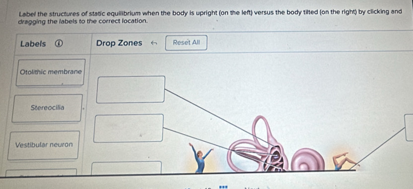 Solved: Label the structures of static equilibrium when the body is ...