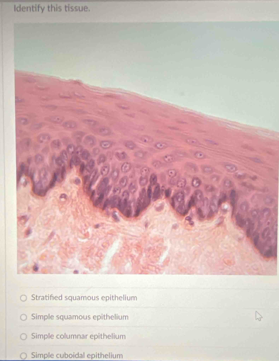 Identify this tissue.
Stratified squamous epithelium
Simple squamous epithelium
Simple columnar epithelium
Simple cuboidal epithelium