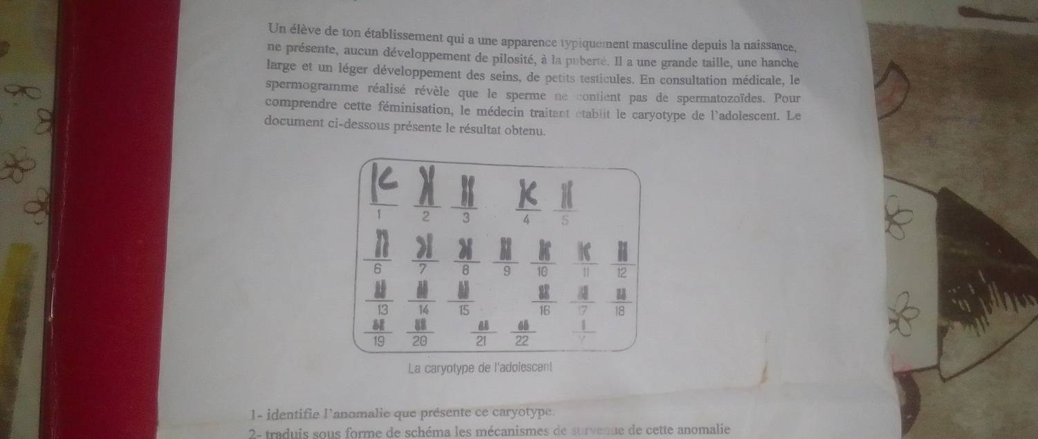 Un élève de ton établissement qui a une apparence typiquement masculine depuis la naissance, 
ne présente, aucun développement de pilosité, à la puberté. Il a une grande taille, une hanche 
large et un léger développement des seins, de petits testicules. En consultation médicale, le 
spermogramme réalisé révèle que le sperme ne contient pas de spermatozoïdes. Pour 
comprendre cette féminisation, le médecin traitant établit le caryotype de l'adolescent. Le 
document ci-dessous présente le résultat obtenu.
4  11/5 
overline 6 7 8  a/9  frac k  if/11   11/12 
overline θ 
||
14  ||/15   8!/16   a/17   14/18 
beginarrayr _  8!/13  48/19  endarray  88/28   68/21   68/22   1/V 
La caryotype de l'adolescent 
1- identifie l'anomalie que présente ce caryotype. 
2- traduis sous forme de schéma les mécanismes de survenue de cette anomalie