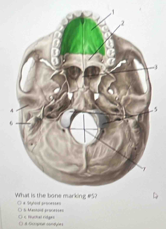 3
5
a Styloid processes
5. Mastoid processes
€ Nuchal ridges
d Occipitat condyles