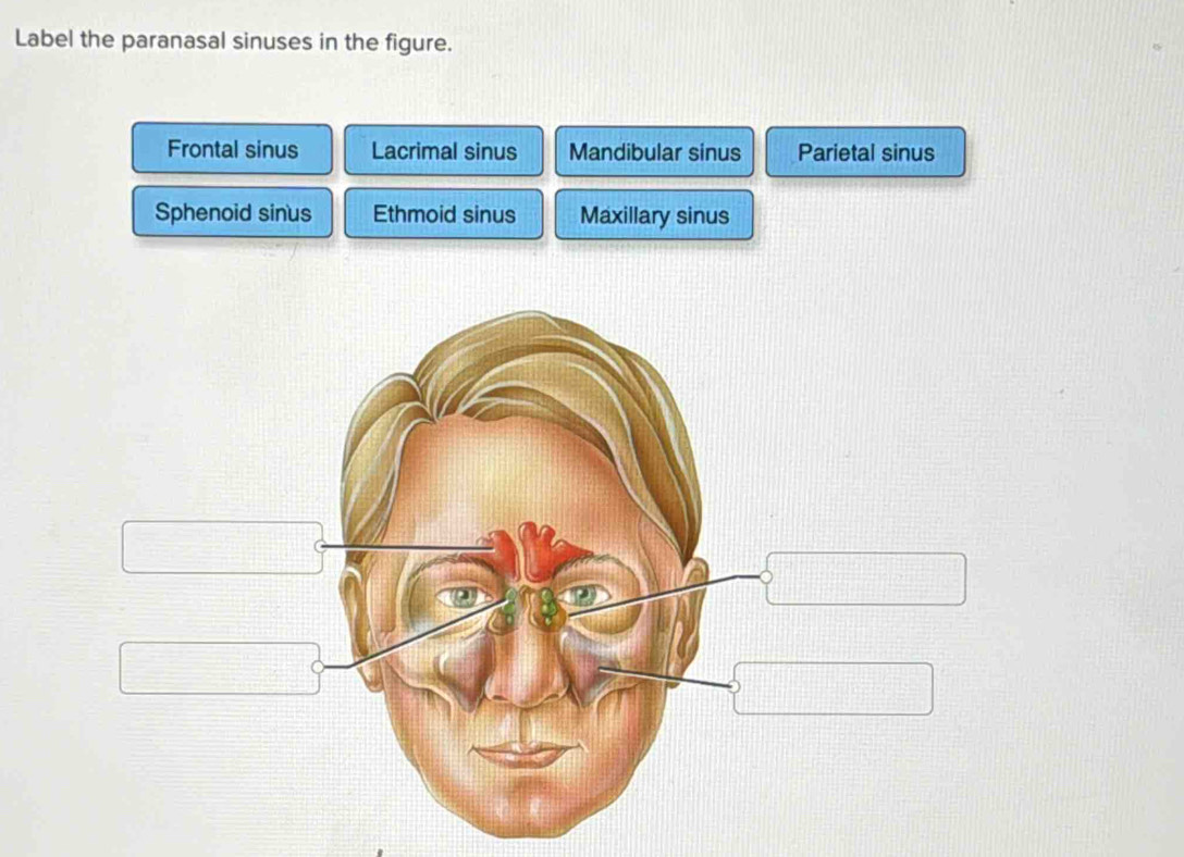 Solved: Label the paranasal sinuses in the figure. Frontal sinus ...