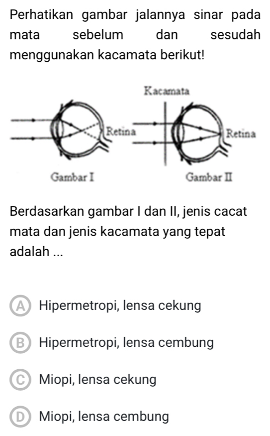 Perhatikan gambar jalannya sinar pada
mata sebelum dan sesudah
menggunakan kacamata berikut!
Berdasarkan gambar I dan II, jenis cacat
mata dan jenis kacamata yang tepat
adalah ...
A Hipermetropi, lensa cekung
B Hipermetropi, lensa cembung
Miopi, lensa cekung
D Miopi, lensa cembung