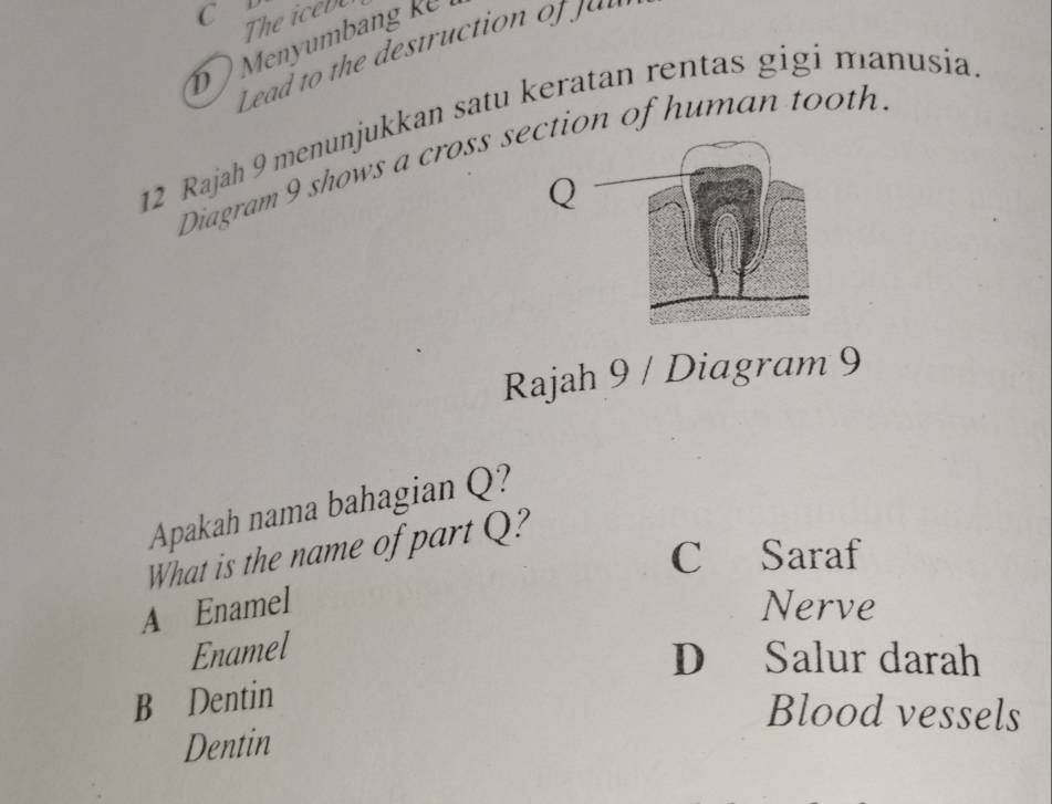 The iceb
12 Rajah 9 menunjukkan satu keratan rentas gigi manusia
Diagram 9 shows a cross sction of human tooth.
Rajah 9 / Diagram 9
Apakah nama bahagian Q?
What is the name of part Q?
C Saraf
A Enamel Nerve
Enamel
D Salur darah
B Dentin
Blood vessels
Dentin