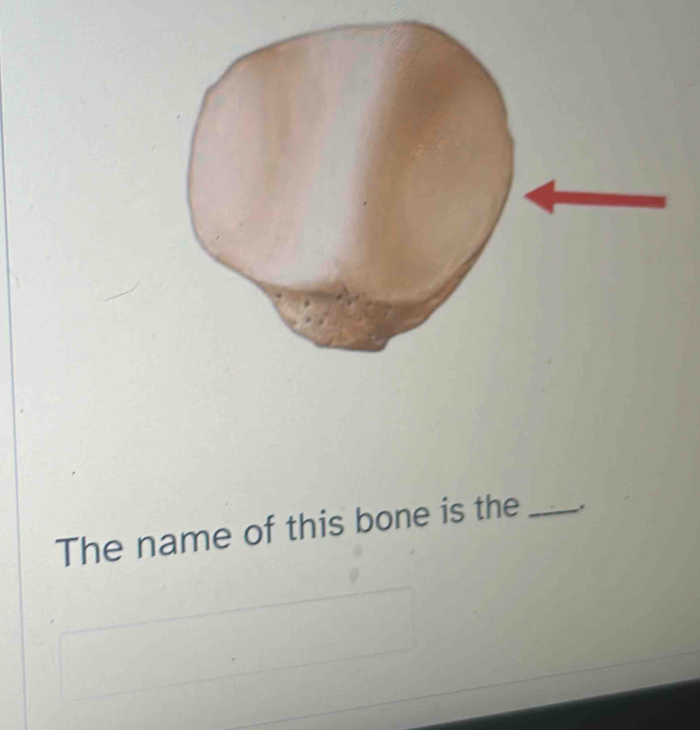 The name of this bone is the _,