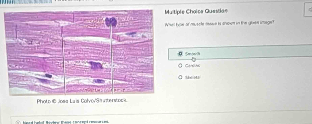 tiple Choice Question 
t type of muscle tissue is shown in the given image? 
Smooth 
Cardiac 
Skeletal 
Photo © Jose Luis Calvo/Shutterstock. 
Need help? Review these concept resources.