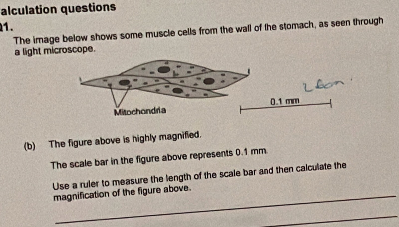 alculation questions 
1. 
The image below shows some muscle cells from the wall of the stomach, as seen through 
a light microscope. 
(b) The figure above is highly magnified. 
The scale bar in the figure above represents 0.1 mm. 
Use a ruler to measure the length of the scale bar and then calculate the 
magnification of the figure above. 
_