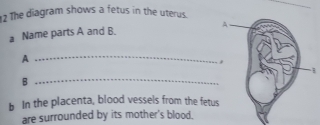 The diagram shows a fetus in the uterus. 
a Name parts A and B. 
_A 
B 
_B 
b In the placenta, blood vessels from the fetus 
are surrounded by its mother's blood.