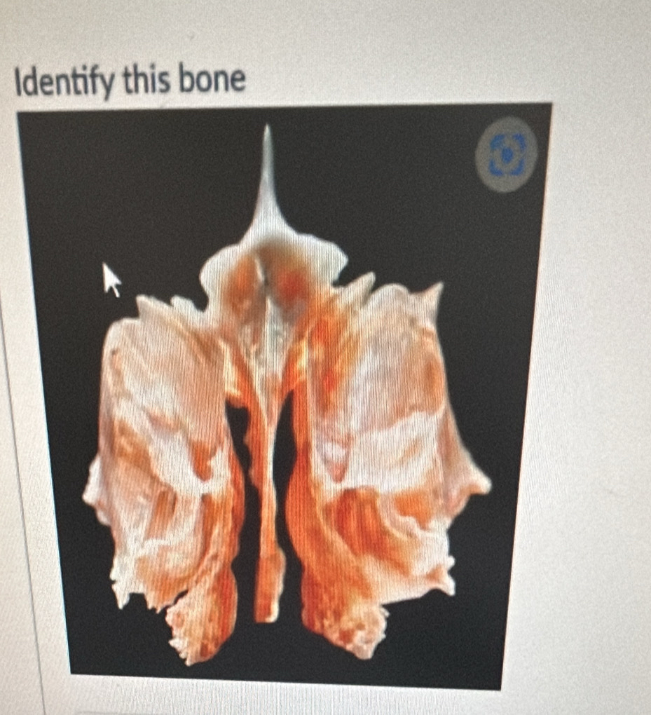 Identify this bone