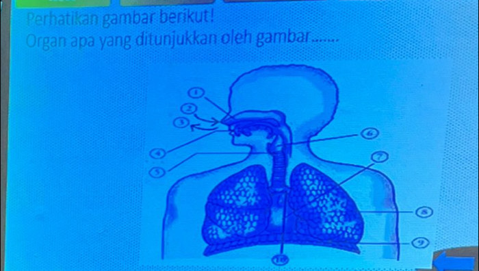 Perhatikan gambar berikut! 
Organ apa yang ditunjukkan oleh gambar_ 
a