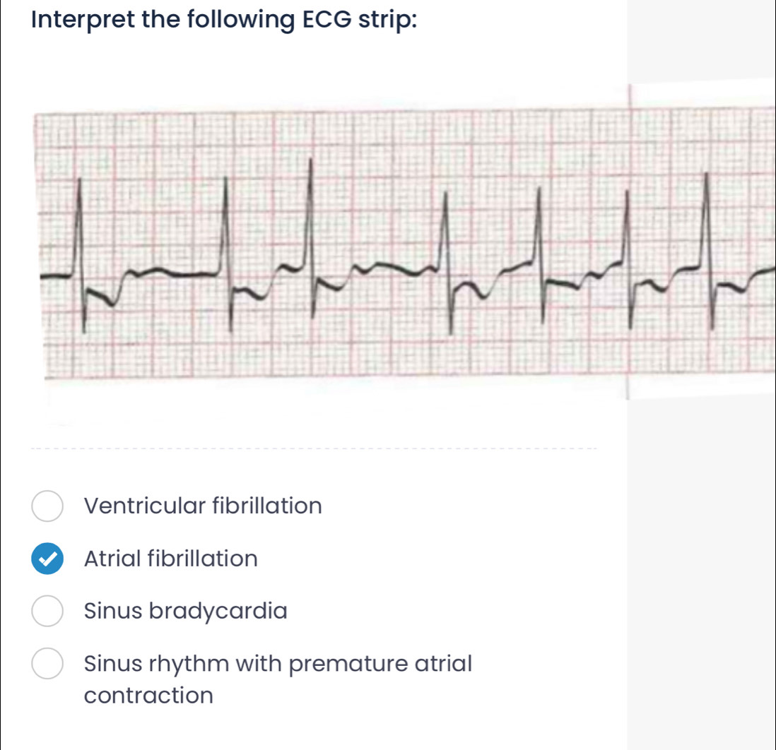 Interpret the following ECG strip:
Ventricular fibrillation
Atrial fibrillation
Sinus bradycardia
Sinus rhythm with premature atrial
contraction