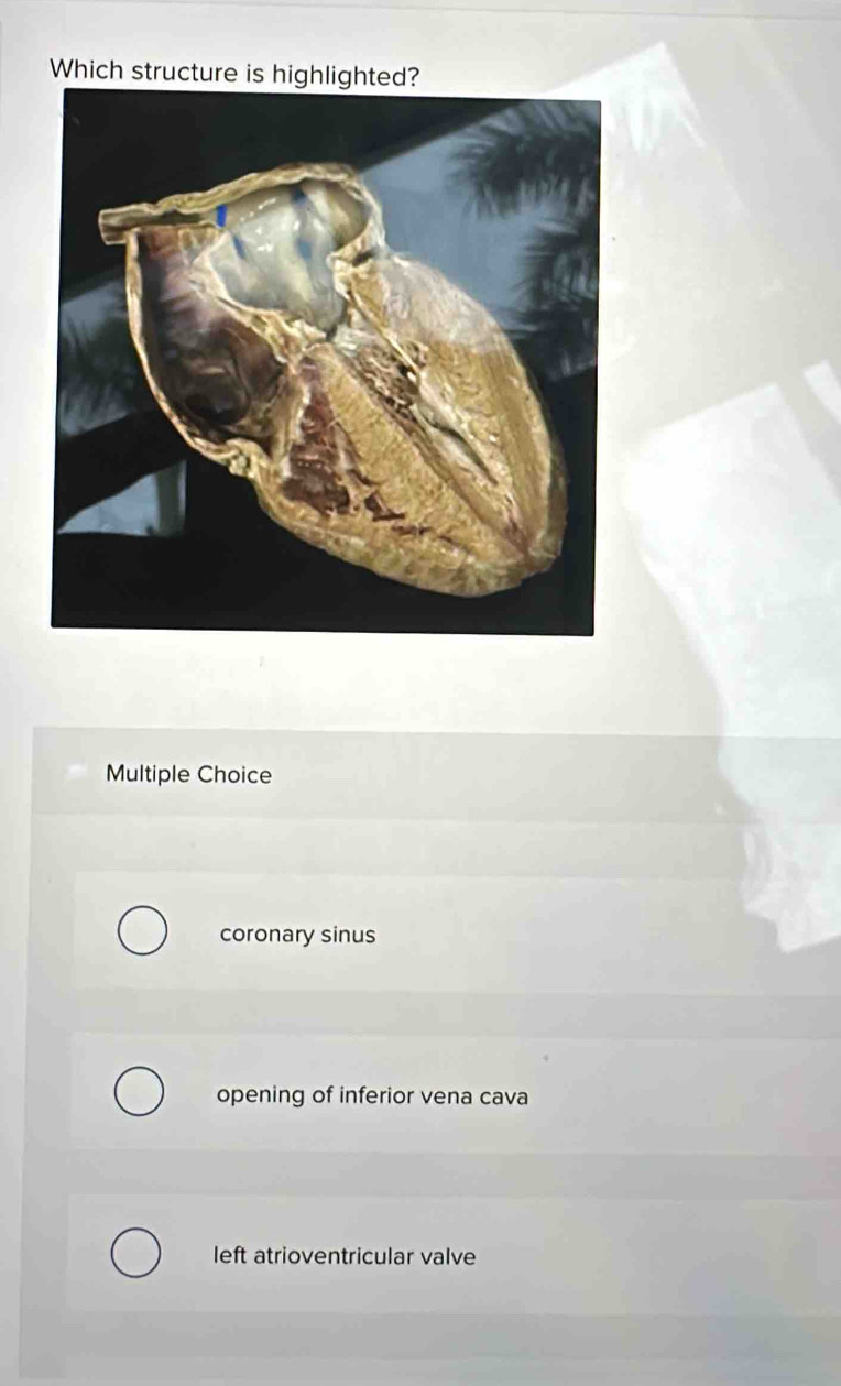 Which structure is highlighted?
Multiple Choice
coronary sinus
opening of inferior vena cava
left atrioventricular valve