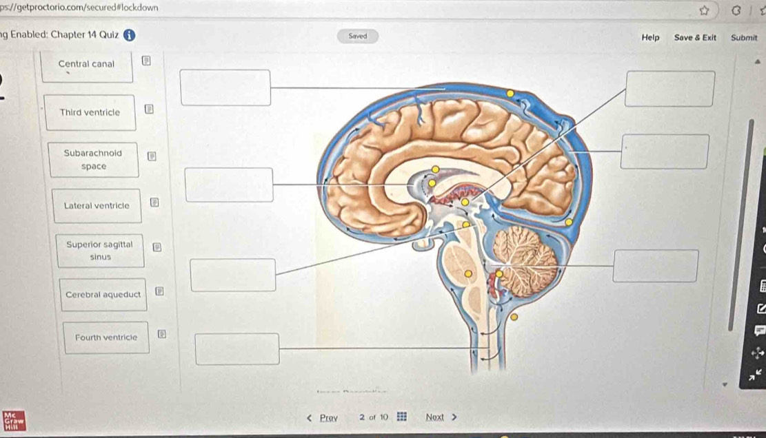 Enabled: Chapter 14 Quiz Saved Help Save & Exit Submit
Central canal
Third ventricle
Subarachnoid
space
Lateral ventricle
Superior sagittal
sinus
Cerebral aqueduct
Fourth ventricle
Pray 2 of 10 Next >