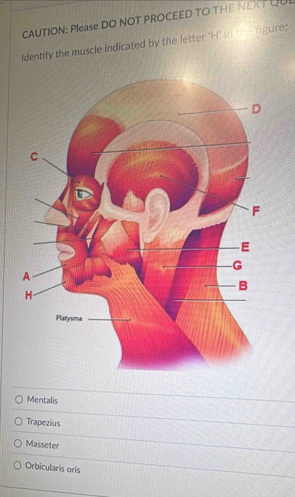 CAUTION: Please DO NOT PROCEED TO THE NEXT QUE
Identify the muscle indicated by the letter 'H' in the ngure;
Mentalis
Trapezius
Masseter
Orbicularis oris