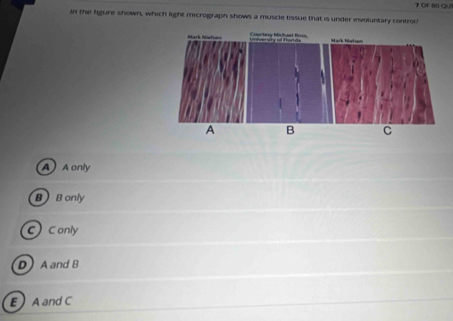 Solved: OF 80 QUI In the figure shown, which light micrograph shows a ...