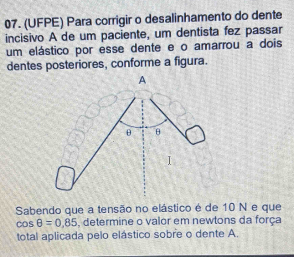 (UFPE) Para corrigir o desalinhamento do dente 
incisivo A de um paciente, um dentista fez passar 
um elástico por esse dente e o amarrou a dois 
dentes posteriores, conforme a figura. 
Sabendo que a tensão no elástico é de 10 N e que
cos θ =0.85 , determine o valor em newtons da força 
total aplicada pelo elástico sobre o dente A.