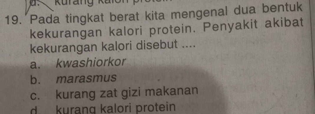 Kurang Kaloi
19. Pada tingkat berat kita mengenal dua bentuk
kekurangan kalori protein. Penyakit akibat
kekurangan kalori disebut ....
a. kwashiorkor
b. marasmus
c. kurang zat gizi makanan
d. kurang kalori protein