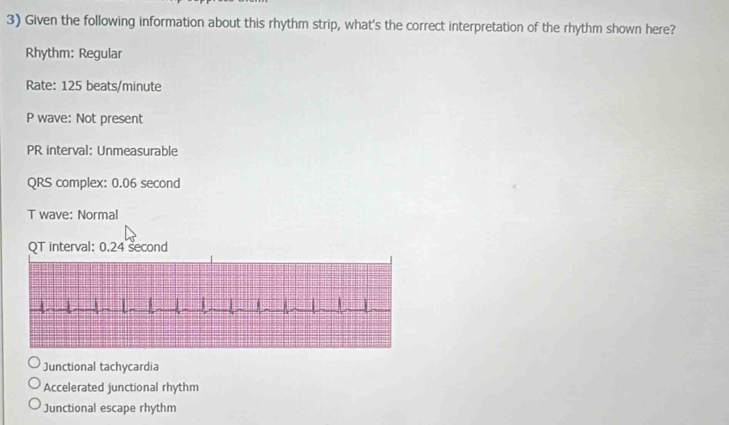 Solved: Given the following information about this rhythm strip, what's ...