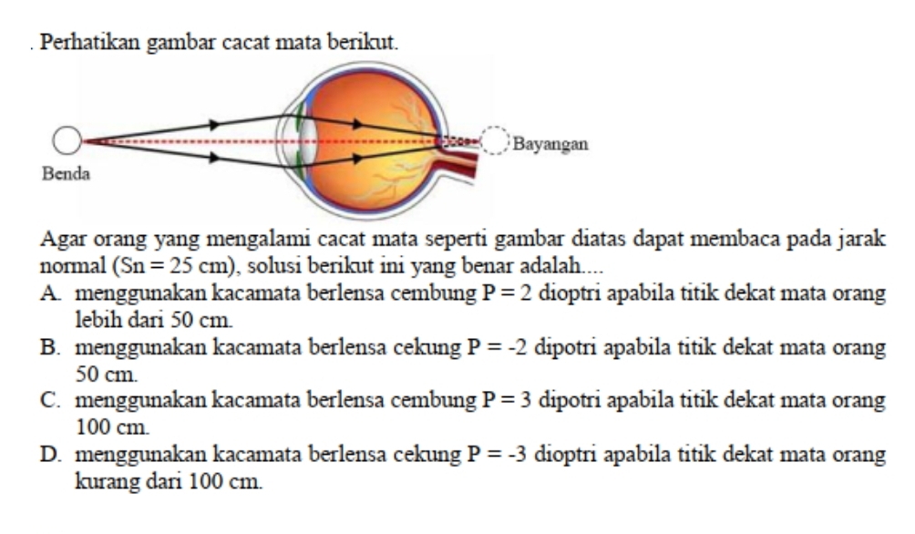 Perhatikan gambar cacat mata berikut.
Agar orang yang mengalami cacat mata seperti gambar diatas dapat membaca pada jarak
normal (Sn=25cm) , solusi berikut ini yang benar adalah....
A. menggunakan kacamata berlensa cembung P=2 dioptri apabila titik dekat mata orang
lebih dari 50 cm.
B. menggunakan kacamata berlensa cekung P=-2 dipotri apabila titik dekat mata orang
50 cm.
C. menggunakan kacamata berlensa cembung P=3 dipotri apabila titik dekat mata orang
100 cm.
D. menggunakan kacamata berlensa cekung P=-3 dioptri apabila titik dekat mata orang
kurang dari 100 cm.