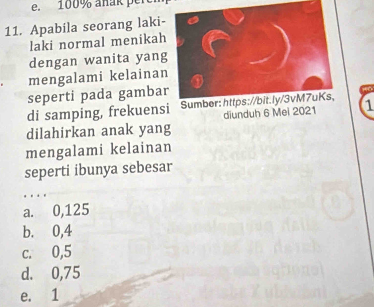 100% äñak per
11. Apabila seorang laki-
laki normal menikah
dengan wanita yang
mengalami kelainan
seperti pada gambar
di samping, frekuensi Sumber: https://bit.ly/3vM7uKs,
diunduh 6 Mei 2021 1
dilahirkan anak yang
mengalami kelainan
seperti ibunya sebesar
a. 0,125
b. 0,4
c. 0,5
d. 0,75
e. 1