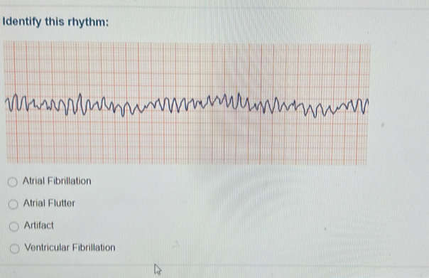 Solved: Identify this rhythm: Atrial Fibrillation Atrial Flutter ...