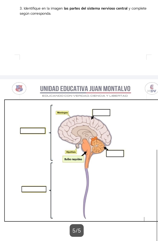 Identifique en la imagen las partes del sistema nervioso central y complete 
según corresponda. 
UNIDAD EDUCATIVA JUAN MONTALVO MDV 
EDUCANDO CON VERDAD, CIENCIA Y LIBERTAD