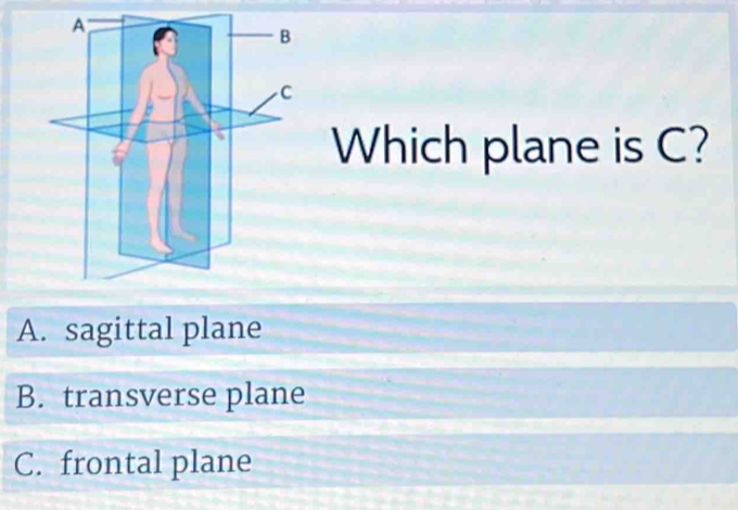Solved: Which plane is C? A. sagittal plane B. transverse plane C ...