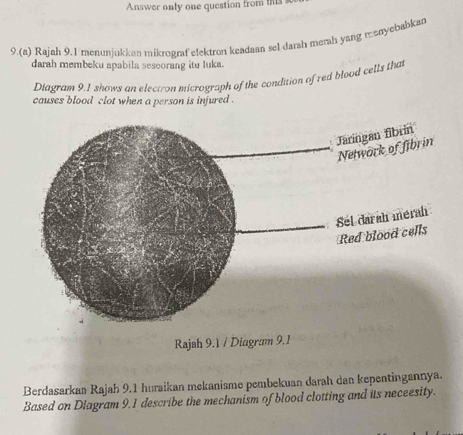 Answer only one question from ns 
9.(a) Rajah 9.1 menunjukkan mikrograf elektron keadaan sel darah merah yang menyebabkan 
darah membeku apabila seseorang itu Iuka. 
Diagram 9.1 shows an electron micrograph of the condition of red blood cells that 
causes blood clot when a person is injured . 
Rajah 9.1 / Diagram 9.1 
Berdasarkan Rajah 9.1 huraikan mekanisme pembekuan darah dan kepentingannya. 
Based on Diagram 9.1 describe the mechanism of blood clotting and its neceesity.