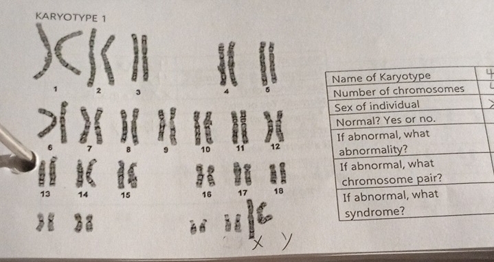 KARYOTYPE 1 
e
13
15
16