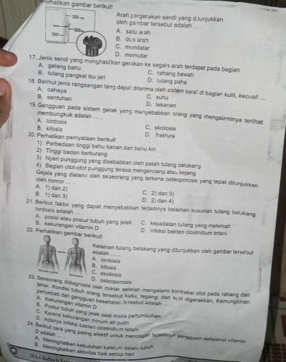 Pematikan gambar!
Arah pergerakan sendi yang d.tunjukkan
oleh gambar tersebut adaiah ... .
A. satu arah
B. dua arah
C.mendatar
D. memutar
17. endi yang menghasi'kan gerakan ke segala arah terdapet pada bagian
A. gelang bahu C. rahang bawah
B. tulang pangkal ibu jari D. tuiang paha
18. Benkut jenis rangsangan tang dapet diterima cleh sistem sara: di bagian kulit, kecuali ...
A. cahaya C. suhu
B. sentuhan D. tekanan
19. Gangguan pada sistem gerak yang menyebabkan orang yang mengaleminya terlihat
membungkuk adalah ... . C. skolosis
A. lardosis D. fraktura
B. kifosils
20. Perhatikan pemyataan berikut!
1) Perbedaan tinggi bahu kanan dan bahu kiri
2) Tinggi badan berkuran
3) Nyer punggung yang disebabkan cleh patah tulang belakang
4) Bagian otot-otot punggung terasa mengercang atau kejang
Gejala yang dialami oleh se3eorang yang terkena osteoporosis yang tepat ditunjukkan
oleh nomor ... .
A. 1) dan 2) C. 2) dan 3)
B. 1) dan 3) D. 2) dan 4)
21. Berkut faktor yang dapat menyebabkan terjadinya kelainan susunan tulang belakang
lordosis adalah ... .
B. kekurangan vitamin D A. posisi atau postur tubuh yang jelek C. kepadatan tulang yang melemah
D. infeksi bakten clostridium tetani
22. Perhatikan gamrikut!
Kelainan tulang belakang yang ditunjukkan oleh gambar tersebut
A. lardosis acalah ... .
C. skoliosis B. kifasis
D. osteoporosis
2seorang didiagnosis oleh dokter setelah mengalami köntraksi otot pada rahang dân
leher, Kondisi tubuh orang tersebut kaku, tegang, dan sclit digerakkan, Kemungkinan
penyebab dan gangquan kesehatan, tersebut adafah ... .
A. Kekurangan vitamin D
B. Postur lubuh yang jelek sast masa pertumbuhan
C. Karens kekurangan minum air putih
D. Adanya infaksi bakteri clostridi um tetani
24. Benkut cara yang paling efektif untuk menoegah togedinye gangguan defisiensi vitamin
D adgigh ... .
A. Meningkatkan kabutuhan kalsium dalam tubüh
B. Meningkatkan aktivitas flalk setisp hari