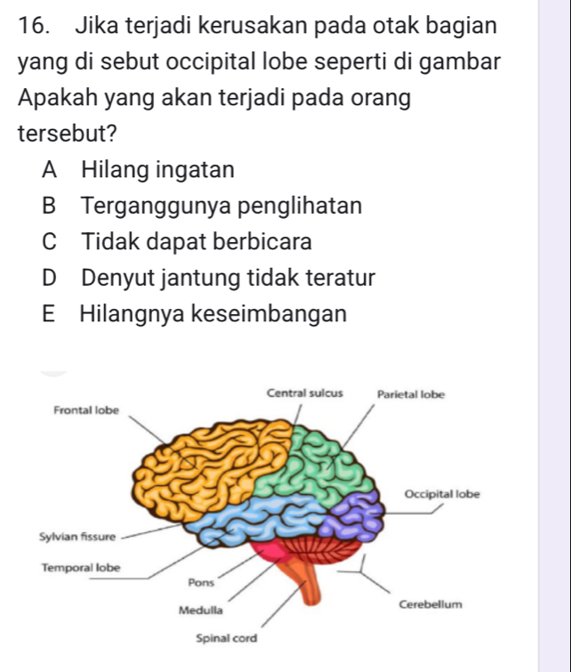 Jika terjadi kerusakan pada otak bagian
yang di sebut occipital lobe seperti di gambar
Apakah yang akan terjadi pada orang
tersebut?
A Hilang ingatan
B Terganggunya penglihatan
C Tidak dapat berbicara
D Denyut jantung tidak teratur
E Hilangnya keseimbangan