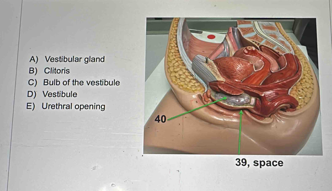 A) Vestibular gland
B) Clitoris
C) Bulb of the vestibule
D) Vestibule
E) Urethral opening
39, space